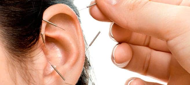auriculoterapia-mi-otro-yo-servicios